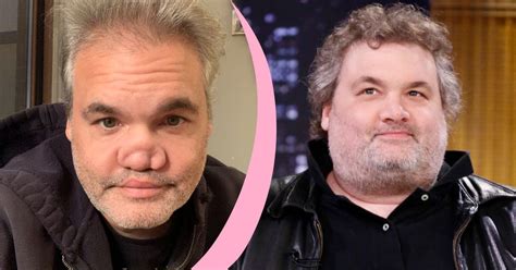 artie lange nose|Artie Lange Reveals What Happened to His Nose 